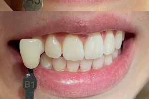 Dental Clinic Κλεμανσώ - Οδοντιατρείο Δρ.Πλακογιαννάκη Ελένη - Χειρουργός οδοντίατρος image