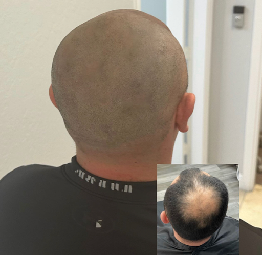 Explore edgar allan poe tattoo ideas, creative tattoo ideas in Roseville, available at NuHair Ink. Scalp MicroPigmentation & Aesthetic Clinic of Sacramento