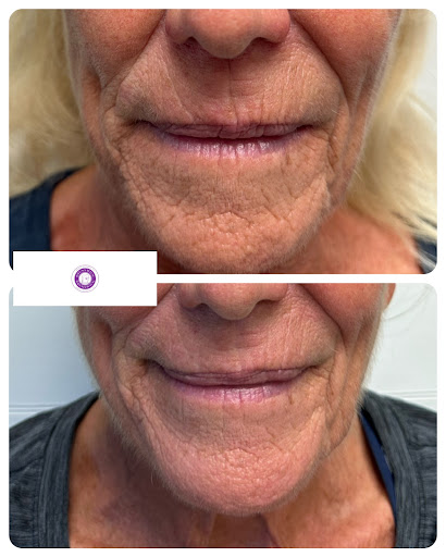 Find tattoo ideas for stepson for your next unique tattoo in Brunswick at Brunswick Medical Aesthetics