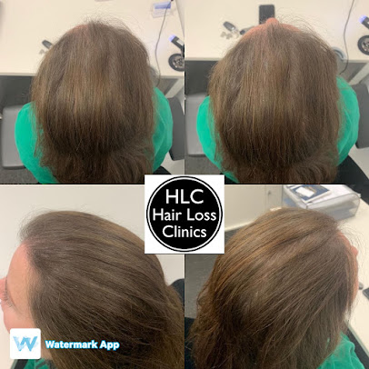 عيادة تساقط الشعر - وارينغتون - Hair Loss Clinic - Warrington
