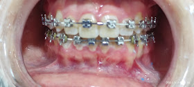 Clínica de Ortodoncia y Estética Dental MaNie Dental
