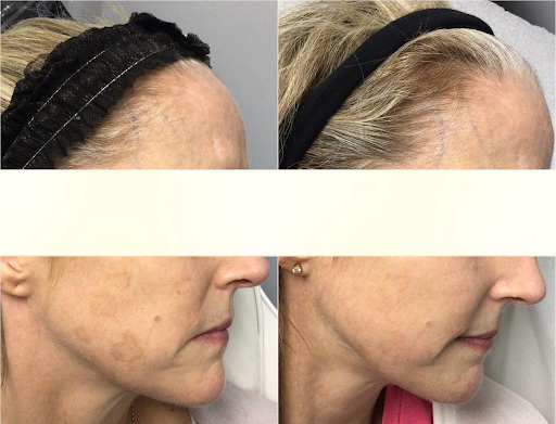 Explore female tattoos ideas, creative tattoo ideas in Everett, available at Renew ND Medspa