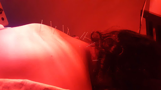 Acupuncture Clinic «Eternal Health & Wellness», reviews and photos, 1066 Saratoga Ave #100, San Jose, CA 95129, USA