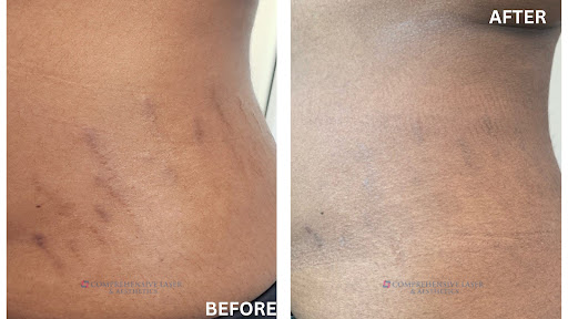 Explore small symbol tattoo ideas, creative tattoo ideas in Columbia, available at Comprehensive Laser & Aesthetics