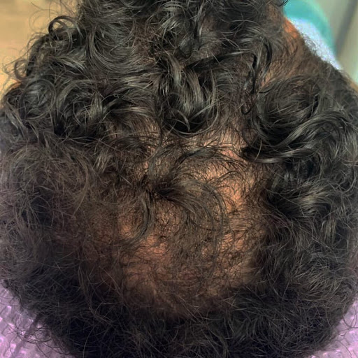 Explore x ray tattoo ideas, creative tattoo ideas in Summit, available at Ethos Aesthetics and Wellness, Laser Hair Removal and Med Spa