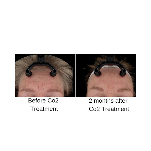 Explore brother tattoo ideas for guys, creative tattoo ideas in Boise, available at Spa 35 Med Spa