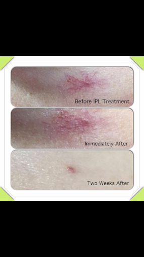 جاذبية الوجه بنتلي - Facial Attraction Bentleigh