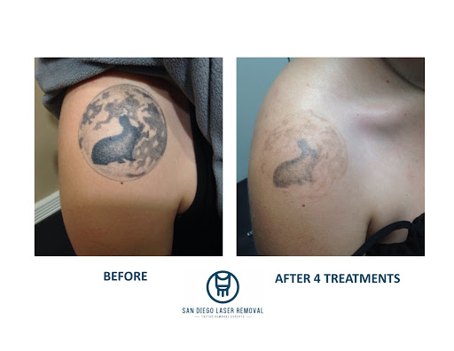 Explore fifth element tattoo ideas, creative tattoo ideas in San Diego, available at Removery Tattoo Removal & Fading