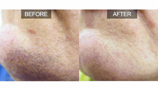 Explore tattoo ideas for first born, creative tattoo ideas in Chino, available at SoCal Body Institute