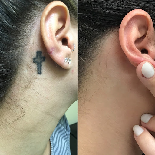 Explore cross sleeve tattoo ideas, creative tattoo ideas in Saint Louis, available at Vanishing Point Laser Tattoo Removal