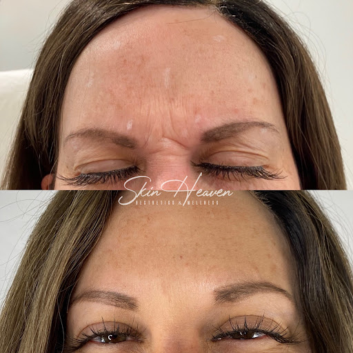 Skin Heaven Aesthetics and Wellness image