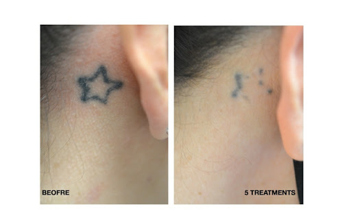 Explore tattoo ideas for men side, creative tattoo ideas in Chino, available at SoCal Body Institute