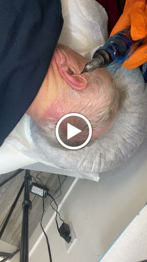 SMP Hair Clinic The Queen Of Scalp image