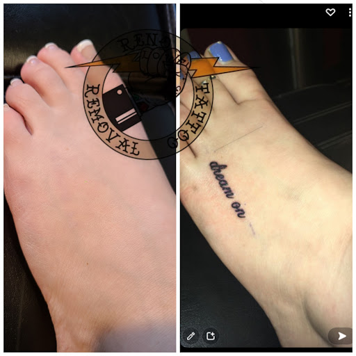 Explore good tattoo ideas forearm, creative tattoo ideas in Reno, available at Reno Tattoo Removal