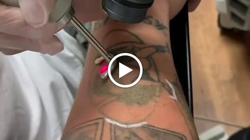 Explore jack tattoo ideas, creative tattoo ideas in Milwaukee, available at Removery Tattoo Removal & Fading