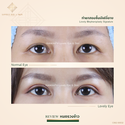 Lovely Eye & Skin Clinic - ทำตาสองชั้น