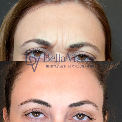 Explore blackout tattoo ideas, creative tattoo ideas in Lakeland, available at Bella Visge Medical & Aesthetic Rejuvenation