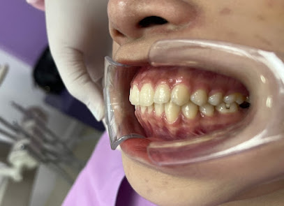 iLike Dental Clinic คลีนิกทันตกรรมไอไลค์ ทำฟัน จัดฟัน รากเทียม พัทยา