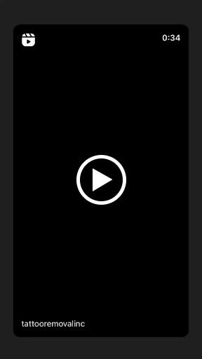 Explore spiral tattoo ideas, creative tattoo ideas in South Gate, available at Tattoo Removal Inc