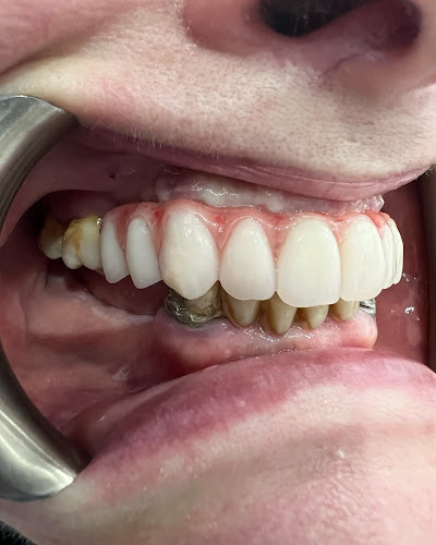 Herts Dental Watford Implant Dentist - Dentist