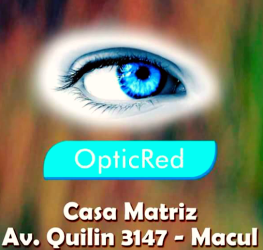 OPTIC-RED OFTALMOLOGIA OPTICA Macul - Macul