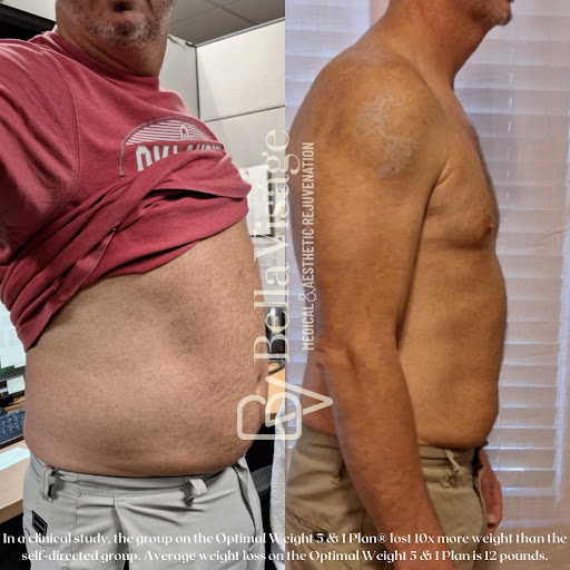 Explore snowmobile tattoo ideas, creative tattoo ideas in Lakeland, available at Bella Visge Medical & Aesthetic Rejuvenation