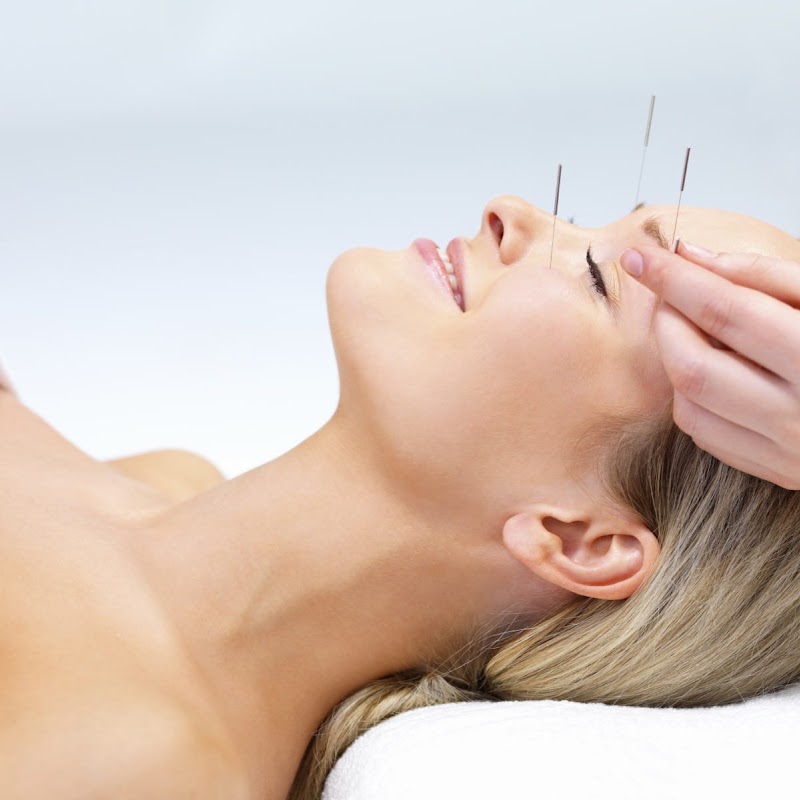 Shammah Acupuncture