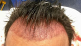 The Holborn Hair Scalp Clinic