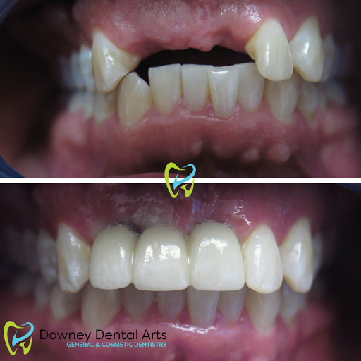 Downey Dental Arts image