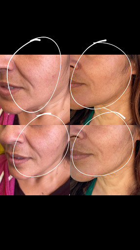 Lifted Beauty Medical Practice image