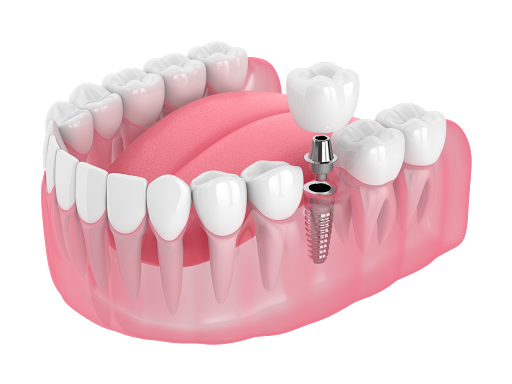 11850 Firestone Blvd, Norwalk, CA 90650, USA