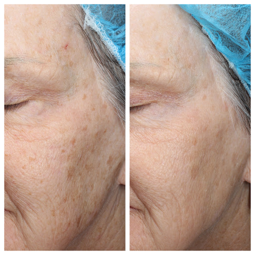 Medical Spa «Carillon Minneapolis Anti-Aging & Skin Clinic», reviews and photos, 755 Bielenberg Dr #104, Woodbury, MN 55125, USA