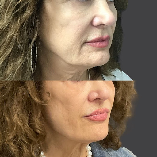 Explore zuko tattoo ideas, creative tattoo ideas in Whittier, available at Skin Perfect Medical Aesthetics