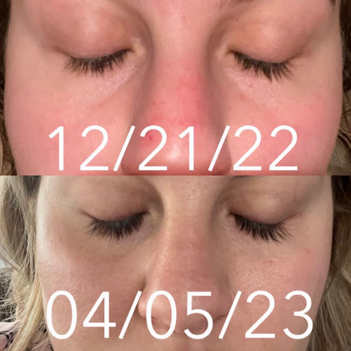 Explore women's leg sleeve tattoo ideas, creative tattoo ideas in Canton, available at JDV Med Spa