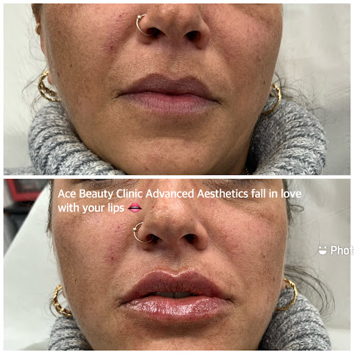 Ace Beauty Clinic - Ace Beauty Clinic