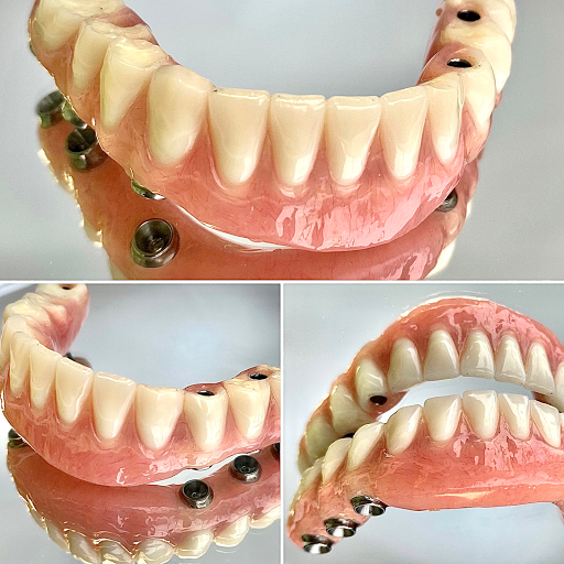 Smile Care Denture Centre | Mississauga Denturist ⭐
