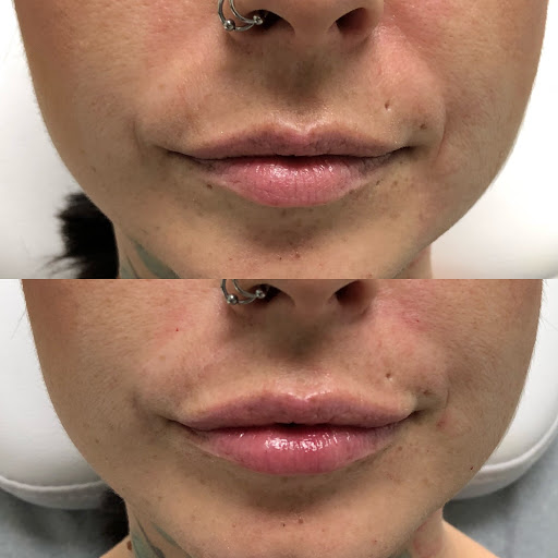 Explore edc tattoo ideas, creative tattoo ideas in Whittier, available at Skin Perfect Medical Aesthetics