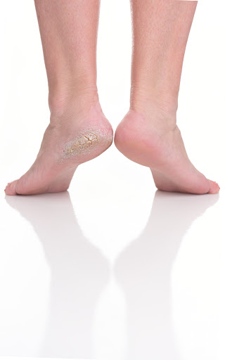Footlogix Pediceuticals® - Foot Care Products