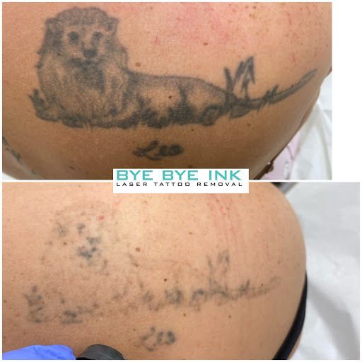Explore rectangle tattoo ideas, creative tattoo ideas in Middle Village, available at Bye Bye Ink Laser Tattoo Removal