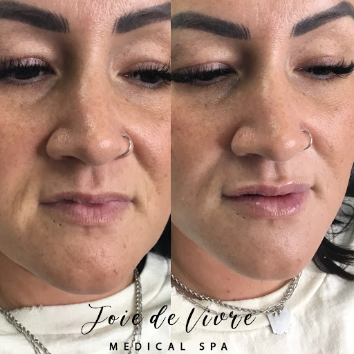 Explore female tattoo ideas for arm, creative tattoo ideas in Canton, available at JDV Med Spa