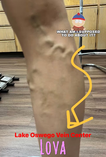 Explore hard working tattoo ideas, creative tattoo ideas in Lake Oswego, available at Lake Oswego Vein and Aesthetic LOVA