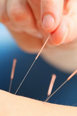 Dr. Joo Acupuncture. Inc (JW Health Care) image