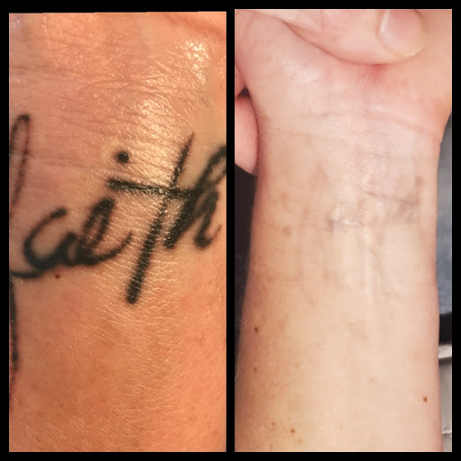 Explore womens bum tattoo ideas, creative tattoo ideas in Dubuque, available at Retrospect Tattoo Removal