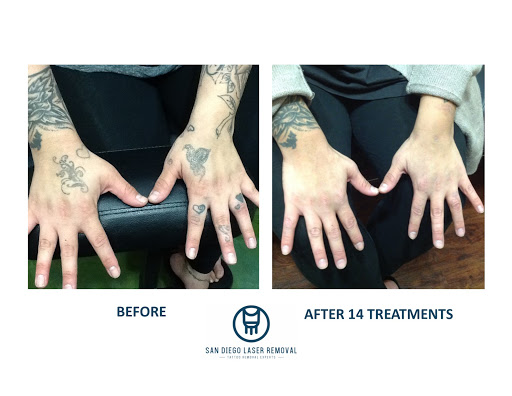 Explore original tattoo ideas for women, creative tattoo ideas in San Diego, available at Removery Tattoo Removal & Fading