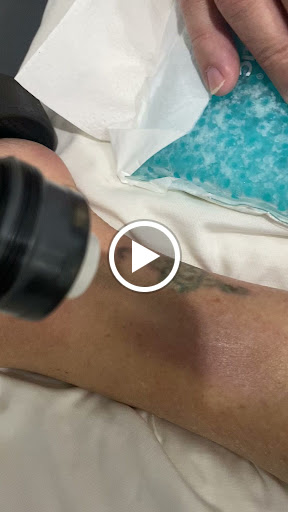 Explore cf tattoo ideas, creative tattoo ideas in Naples, available at Laser Tattoo Removal Services