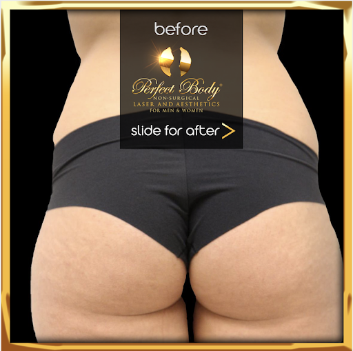 Find angels tattoo ideas for your next unique tattoo in Bay Shore at Perfect Body Laser & Aesthetics