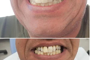 מרפאת שיניים בבת ים - רופא שיניים בבת ים: ד"ר עמוס בוחניק image