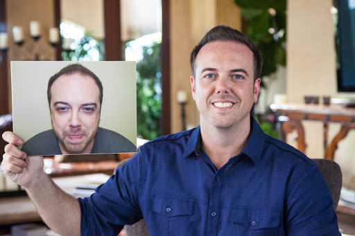 Hair Transplantation Clinic «Bosley Medical - Seattle», reviews and photos, 2505 2nd Ave #715, Seattle, WA 98121, USA