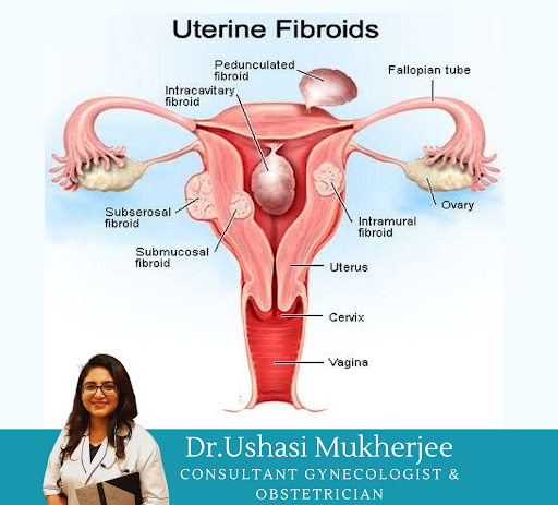 Dr. Ushasi Mukherjee : Best Gynecologist in Purbachal | Best Normal Delivery | Best Infertility Doctor in Haltu