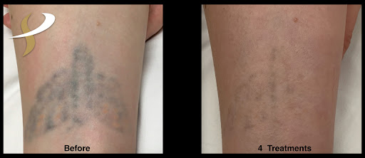 Explore sagittarius tattoo ideas male, creative tattoo ideas in Spokane, available at Premier Body and Laser